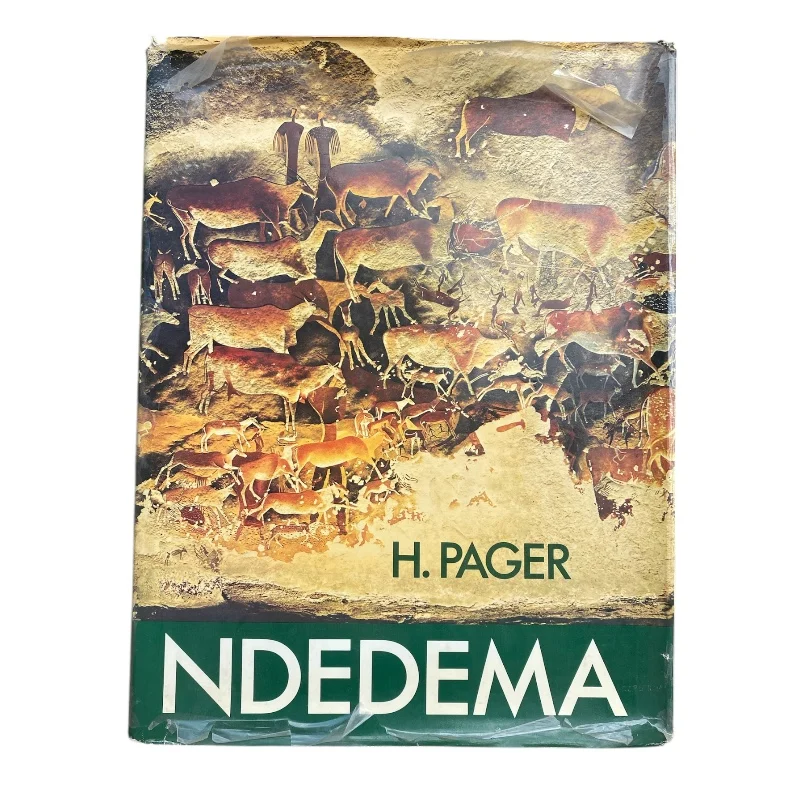 Ndedema