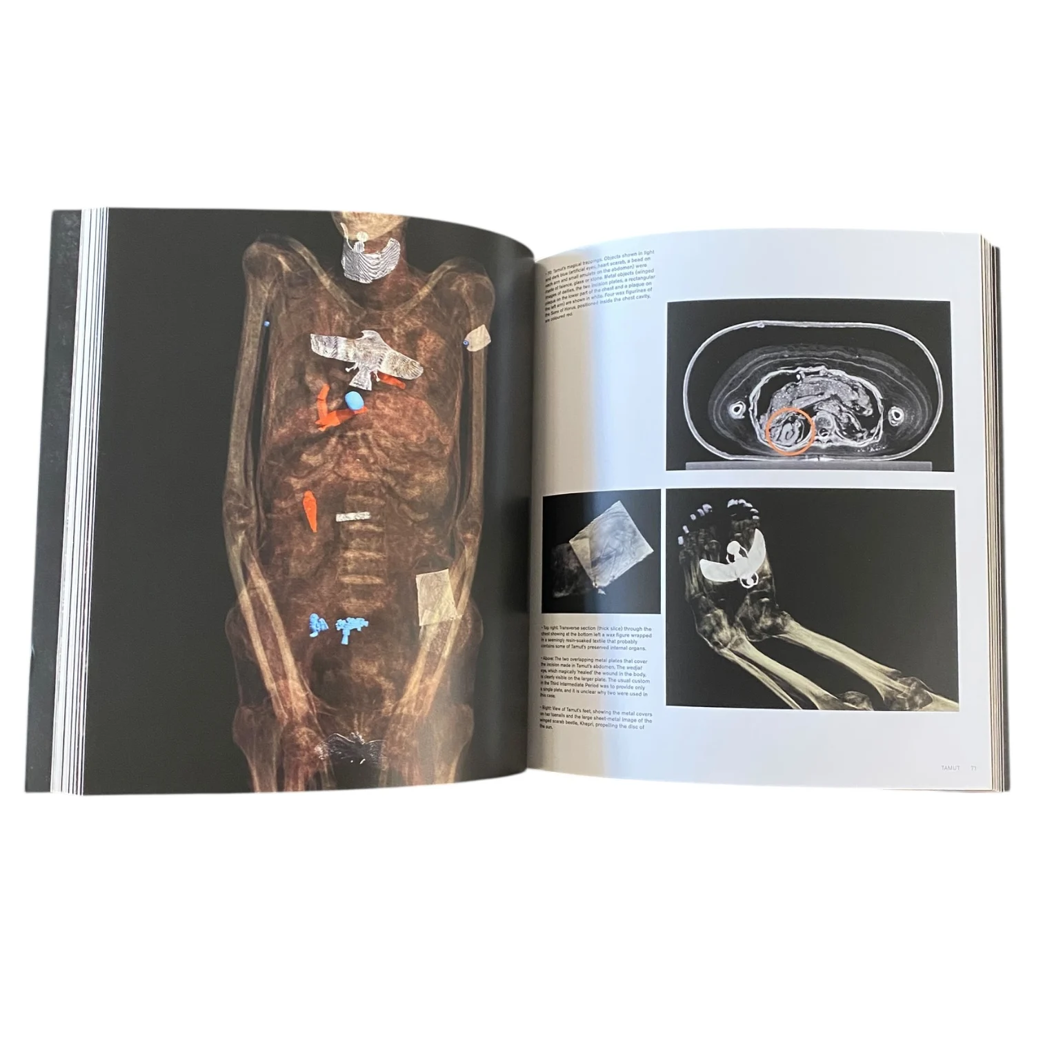 Egyptian Mummies: Exploring Ancient Lives - Image 2